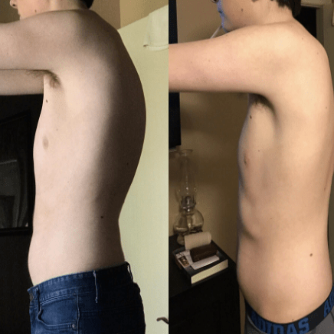 Markaffil™ PosturePal Back Support